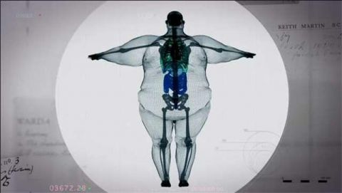 900斤男子接受全身扫描 X光照片惊呆众人