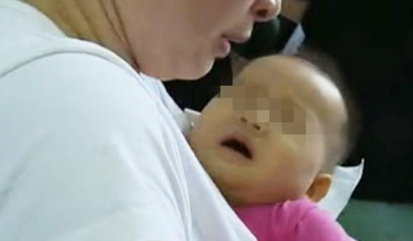 深圳婴儿打疫苗后肝脏严重受损 脸和眼睛变黄