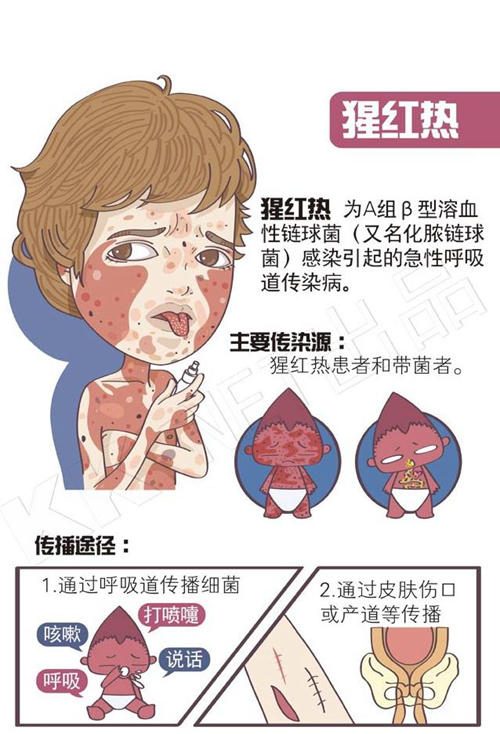 山东进入猩红热高发季节 怎样预防看这里
