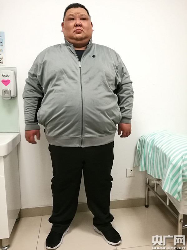 38岁体重近420斤 医院两体重秤接连超极限爆表