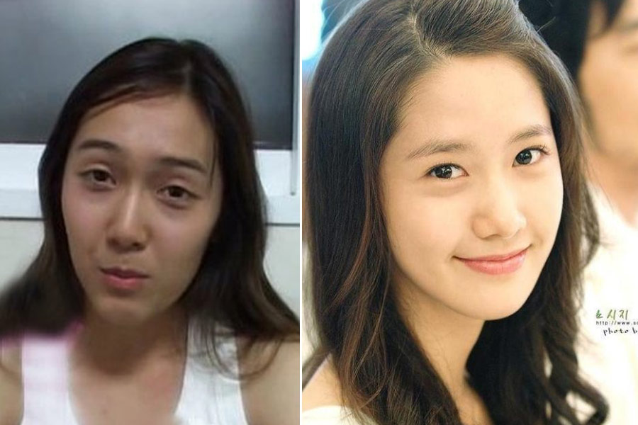 林允儿被誉为少女时代中的"第一美人",整容前底子还是不错的,但眼袋