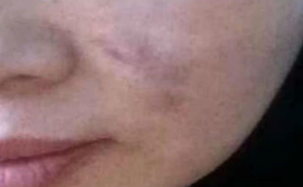 东营女子美容险变“毁容” 记者调查:所谓诊所并无资质_央广网